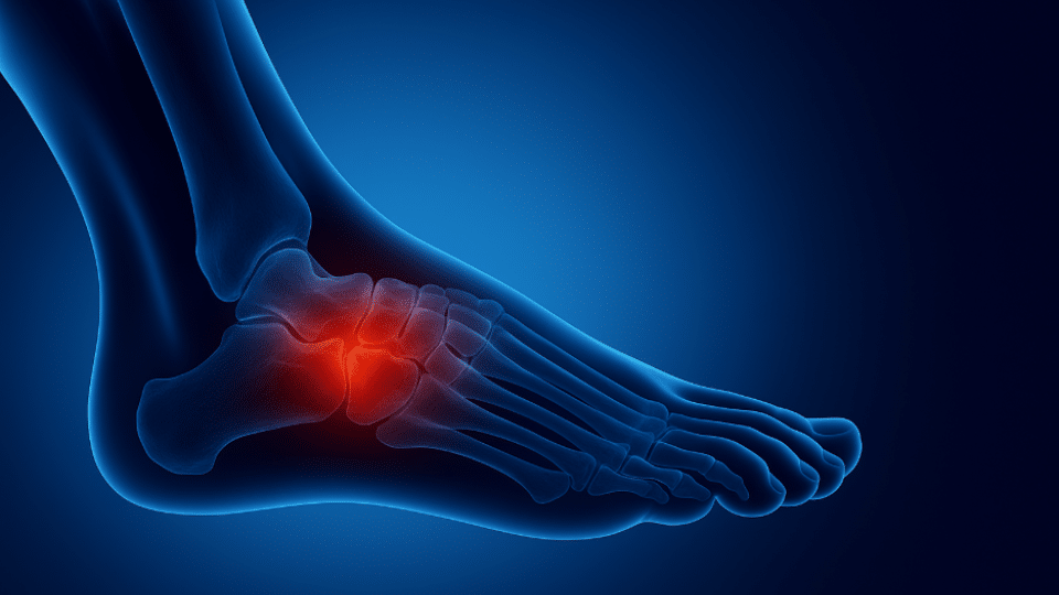 lupus and foot pain