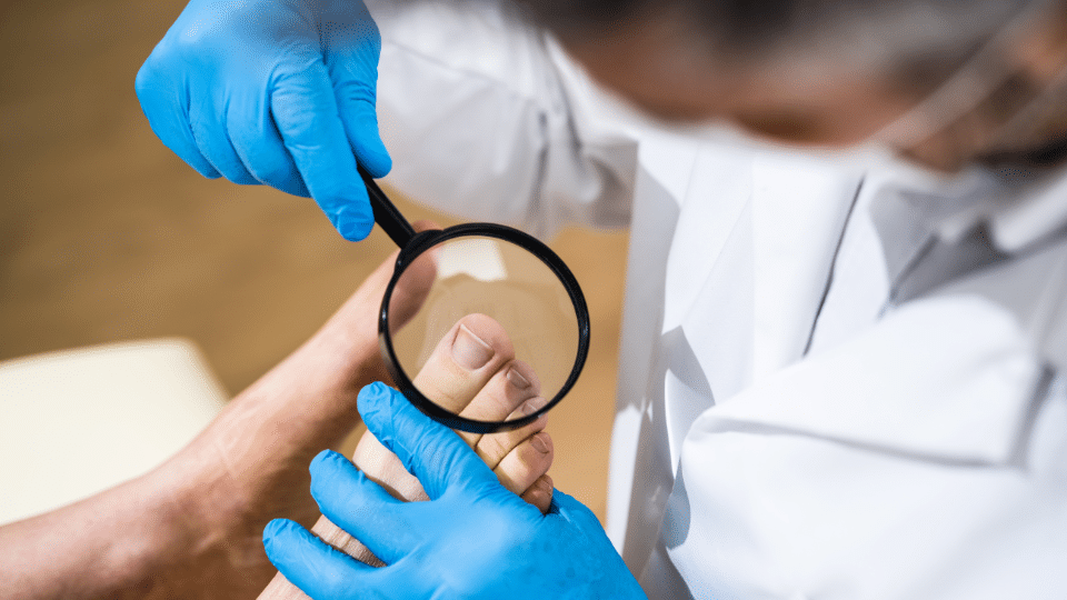 are ingrown toenails genetic