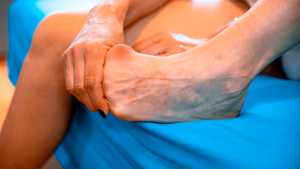 can bunions cause pain in other parts of the foot​