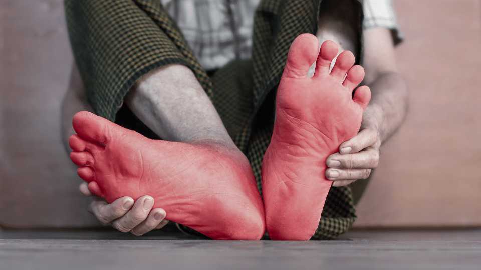 can you have neuropathy without diabetes​