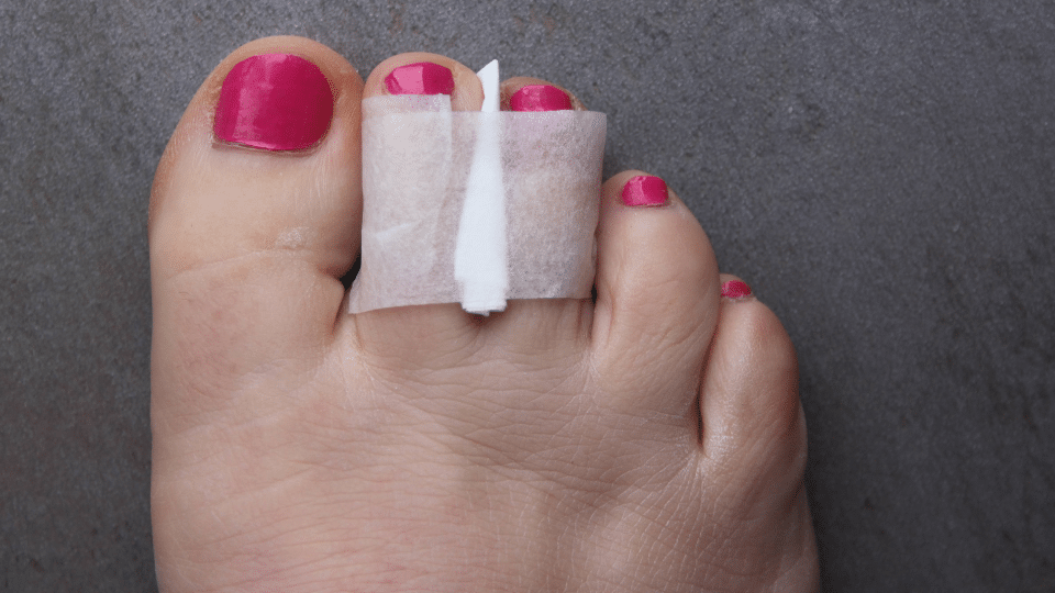 how do u know if your toe is broken